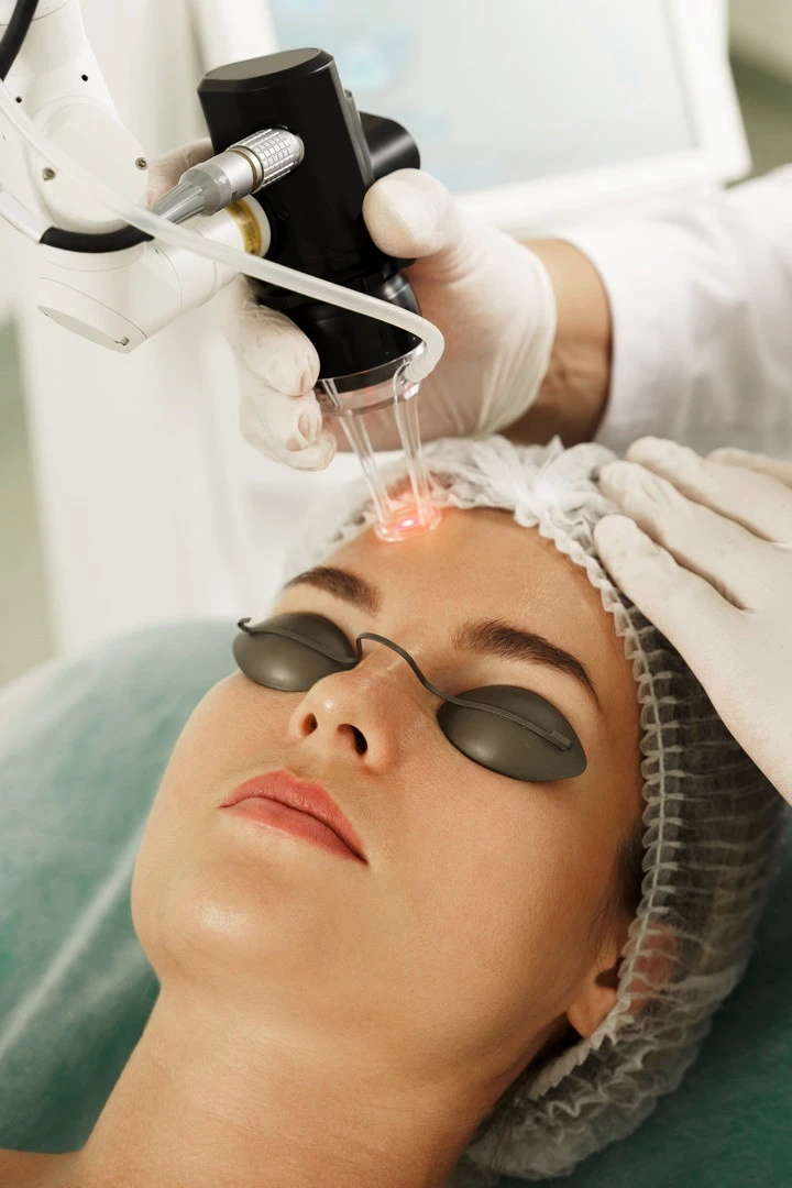 Laser en Esthétique
